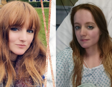 Woman with type 1 eating disorder speaks out for World Diabetes Day